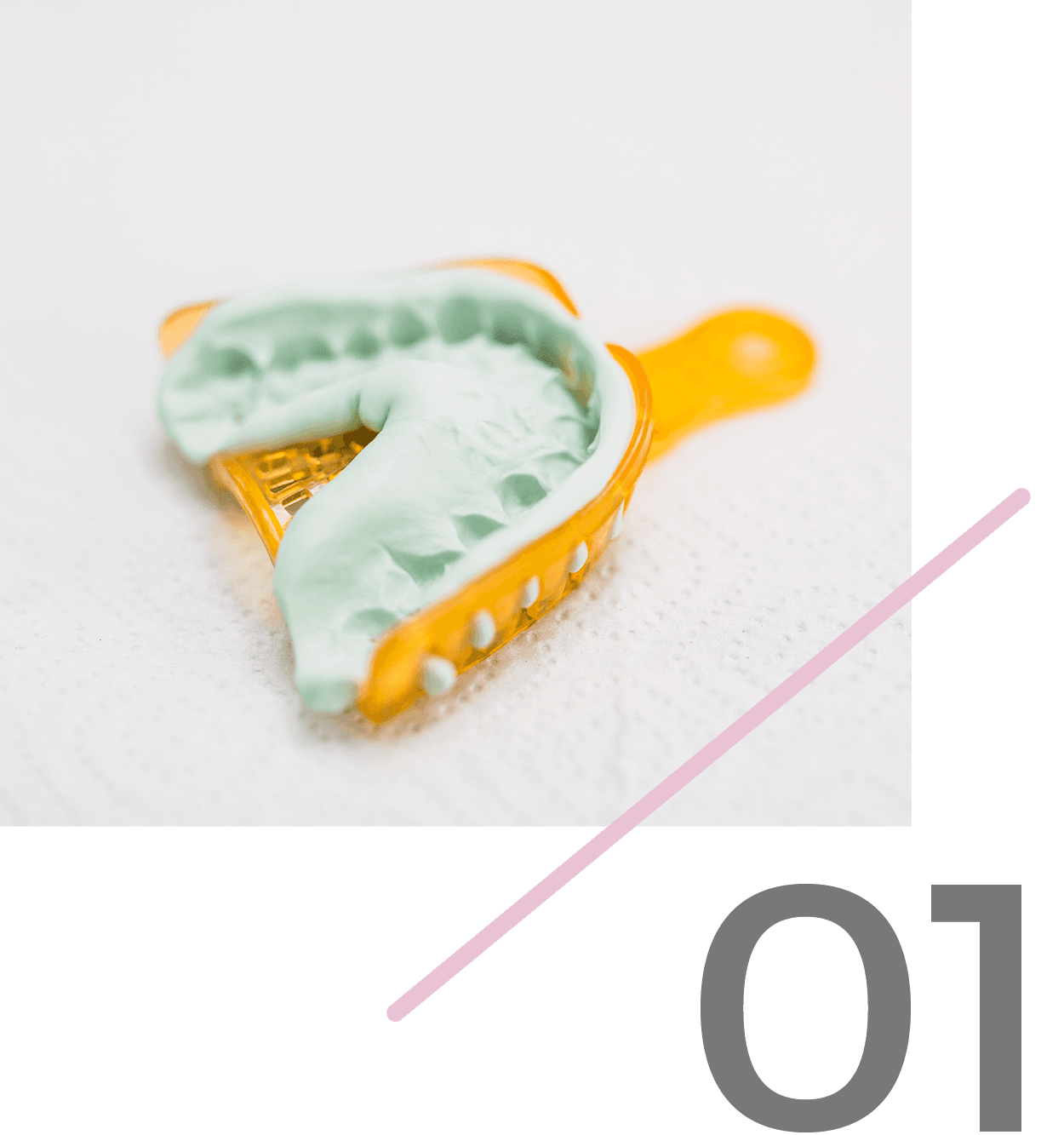 Paso 1: Envíe una impresión dental analógica o modelo a Rivfor Dental Lab