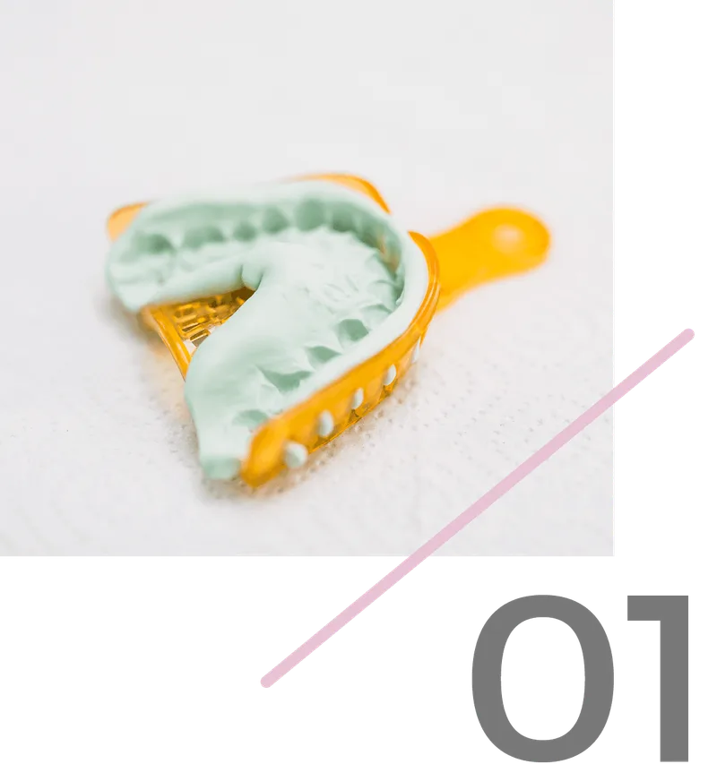 Step 1: Send an analog dental impression or model to Rivfor Dental Lab