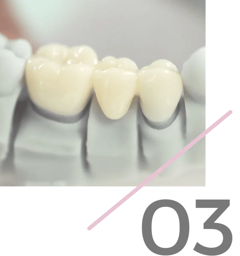 Step 3: Zirconia restoration delivered to your dental practice