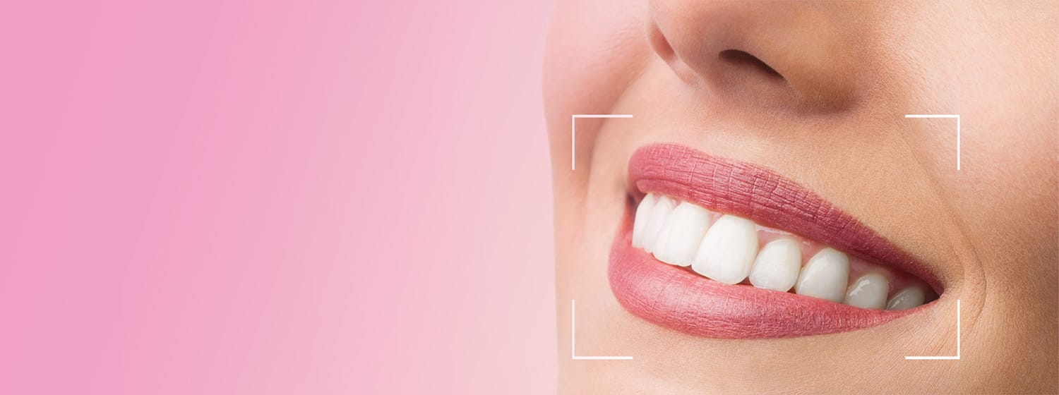 Mujer sonriendo después de recibir restauraciones dentales de zirconia de Rivfor Dental Lab en Miami